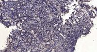 RIOK1 Polyclonal Antibody