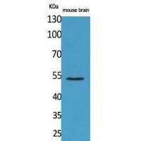 CPE Polyclonal Antibody