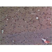 CPE Polyclonal Antibody