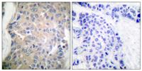 CPI-17 Polyclonal Antibody