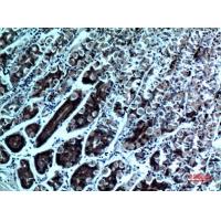 cPLA2 Polyclonal Antibody