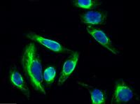 cPLA2 Polyclonal Antibody