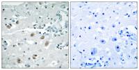 cPLA2-δ Polyclonal Antibody