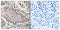 cPLA2-ε Polyclonal Antibody