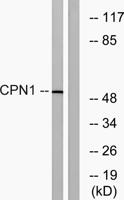 CPN Polyclonal Antibody