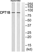 CPTI-M Polyclonal Antibody