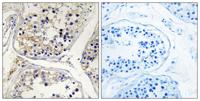 CPTI-M Polyclonal Antibody