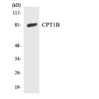 CPTI-M Polyclonal Antibody