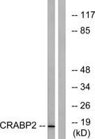 CRABP-II Polyclonal Antibody