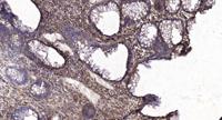 CRABP-II Polyclonal Antibody