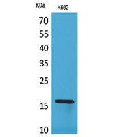 CRBP II Polyclonal Antibody