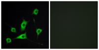 CRBP-III Polyclonal Antibody