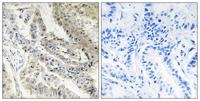 CRBP-III Polyclonal Antibody