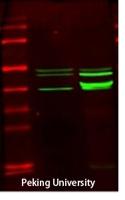 Creatine Kinase M Polyclonal Antibody