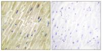 Creatine Kinase M Polyclonal Antibody