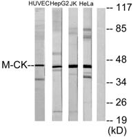 Creatine Kinase M Polyclonal Antibody