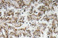 CRF Polyclonal Antibody