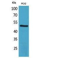 CRF-RI Polyclonal Antibody