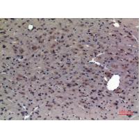 CRF-RI Polyclonal Antibody