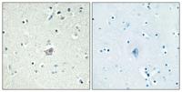 CRF-RII Polyclonal Antibody