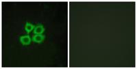 CRF-RII Polyclonal Antibody