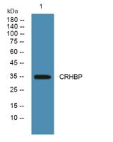 CRHBP Polyclonal Antibody