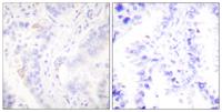 Crk II Polyclonal Antibody