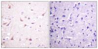 CRMP-2 Polyclonal Antibody