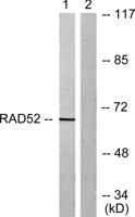 CRMP-2 Polyclonal Antibody