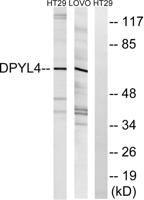 CRMP-3 Polyclonal Antibody
