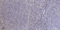 CROT Polyclonal Antibody