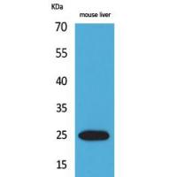 CRP Polyclonal Antibody