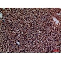 CRP Polyclonal Antibody