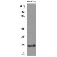 CRP Polyclonal Antibody
