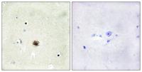 CRP1 Polyclonal Antibody