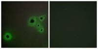 CRSP130 Polyclonal Antibody