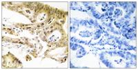 CRSP130 Polyclonal Antibody