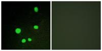 CRSP150 Polyclonal Antibody