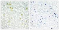 CRSP150 Polyclonal Antibody
