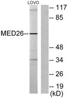 CRSP70 Polyclonal Antibody