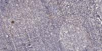 CRSP77 Polyclonal Antibody