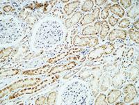 Crystallin-αB Polyclonal Antibody