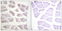 Crystallin-αB Polyclonal Antibody