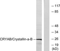 Crystallin-αB Polyclonal Antibody