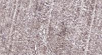 CSB Polyclonal Antibody