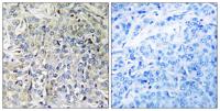 CsGalNAcT-2 Polyclonal Antibody