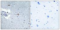 CSGlcA-T Polyclonal Antibody
