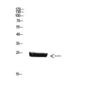 CSH1 Polyclonal Antibody