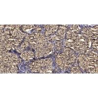 CSH1 Polyclonal Antibody