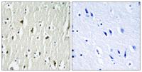 Csk Polyclonal Antibody